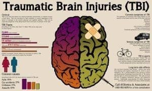 Denver Brain Injury Attorney Infographic
